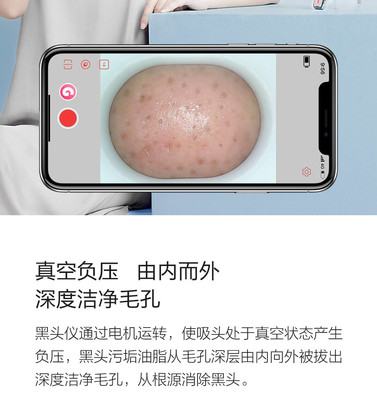 小米有品媄拾智能可視吸黑頭儀 告別黑頭，開啟“眼見為實”的清潔新時代